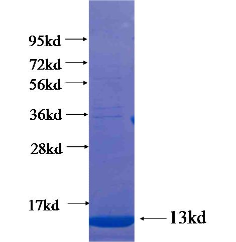 Recombinant human SESN3 SDS-PAGE