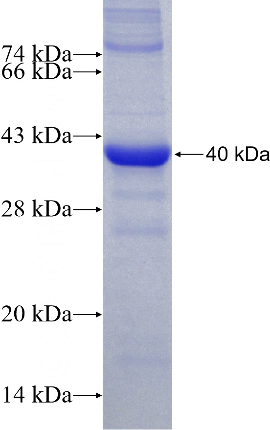 Recombinant Human MGLL SDS-PAGE