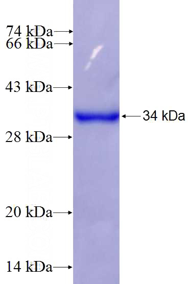 Recombinant Human RRAS SDS-PAGE