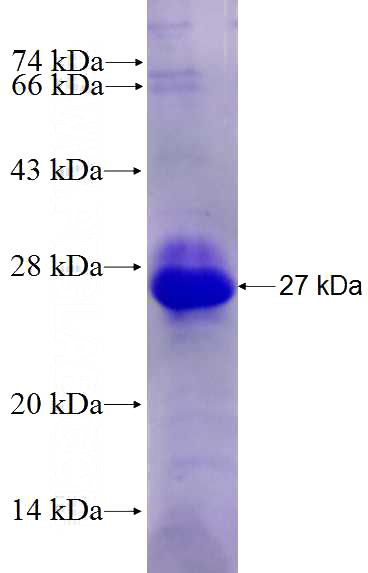 Recombinant Human RSAD2 SDS-PAGE
