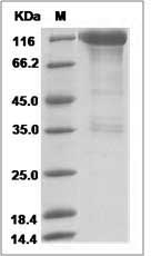 Cynomolgus HER2 / ErbB2 Protein (Fc Tag) SDS-PAGE