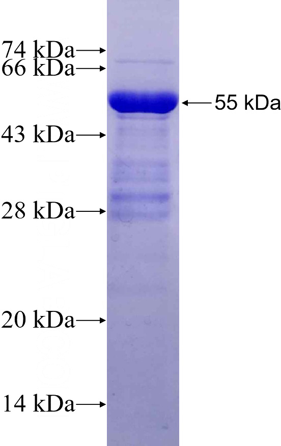 Recombinant Human Dendrin SDS-PAGE