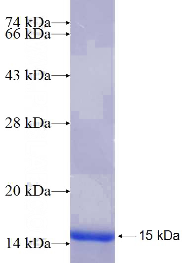 Recombinant Human IGF2BP1 SDS-PAGE
