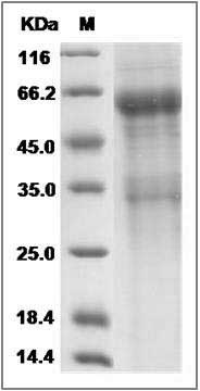 Rat IL20RB Protein (Fc Tag) SDS-PAGE