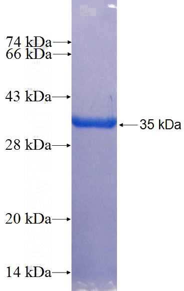 Recombinant Human NDNL2 SDS-PAGE