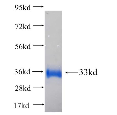 Recombinant human DLX6 SDS-PAGE