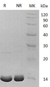 Human ACYP1/ACYPE (His tag) recombinant protein