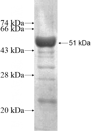 Recombinant Human DNAJA1 SDS-PAGE