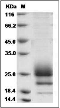 Cynomolgus CD160 Protein (His Tag) SDS-PAGE