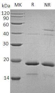 Human HSPB7/CVHSP (His tag) recombinant protein