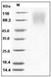 Human LAMP1 / CD107a Protein (His Tag) SDS-PAGE