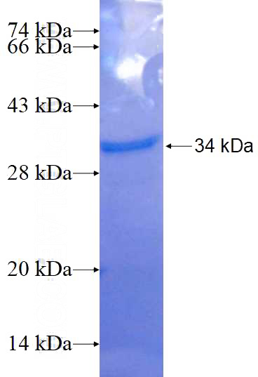 Recombinant Human NEURL2 SDS-PAGE