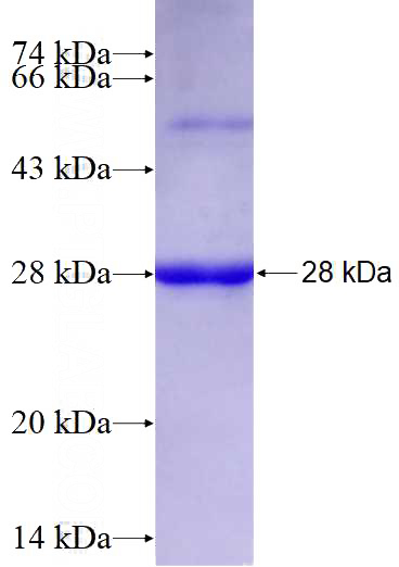 Recombinant Human RAB37 SDS-PAGE