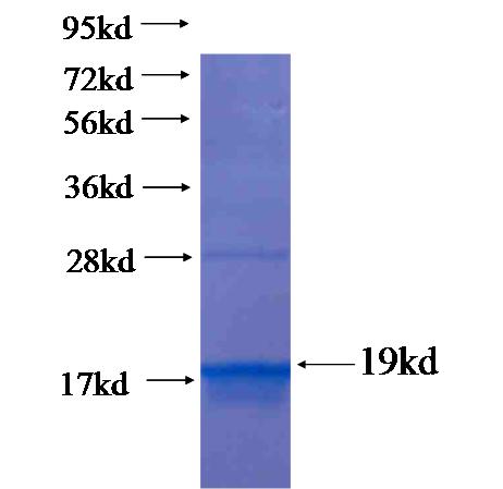 Recombinant human DPPA5(Full length) SDS-PAGE