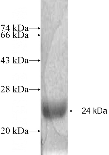 Recombinant Human MRPL50 SDS-PAGE