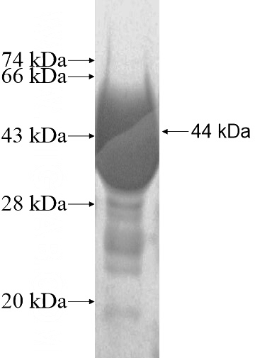 Recombinant Human UGT1A9 SDS-PAGE