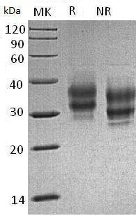 Mouse Folr1/Fbp1/Folbp1 (His tag) recombinant protein