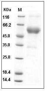 Mouse ALK-1 / ACVRL1 Protein (His & Fc Tag) SDS-PAGE