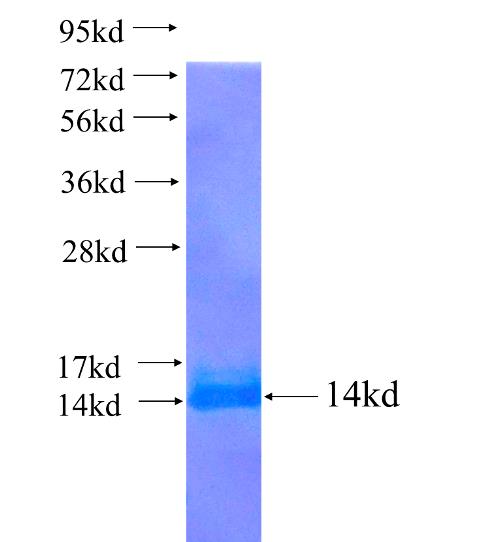 Recombinant human SLC4A3 SDS-PAGE