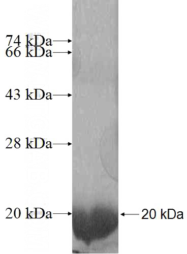 Recombinant Human MYL1 SDS-PAGE