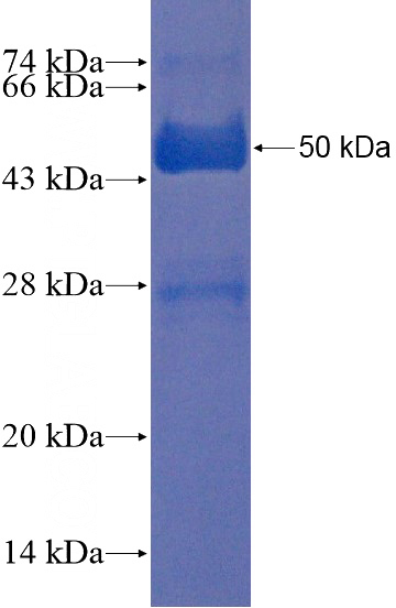 Recombinant Human RBM46 SDS-PAGE