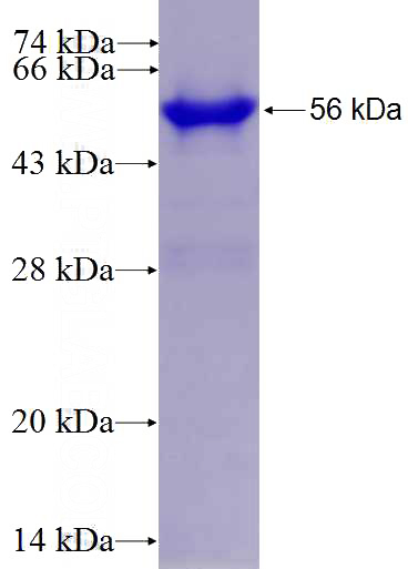 Recombinant Human ABI2 SDS-PAGE