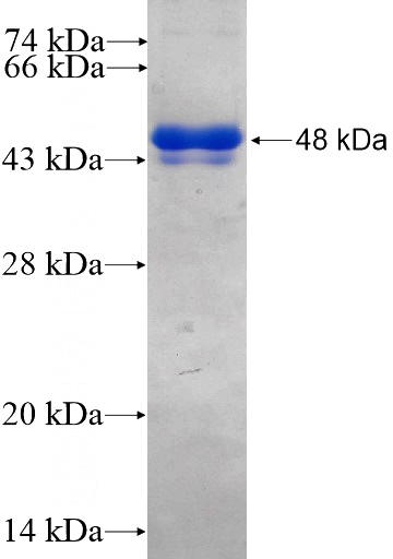 Recombinant Human RBM28 SDS-PAGE