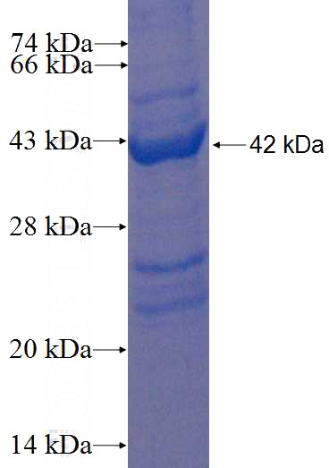 Recombinant Human NDUFAF3 SDS-PAGE