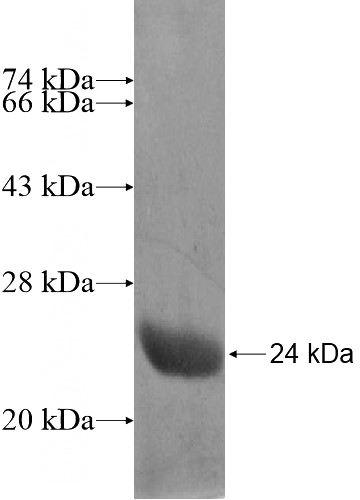 Recombinant Human ZNF614 SDS-PAGE