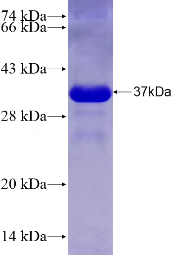 Recombinant Human KIAA1219 SDS-PAGE