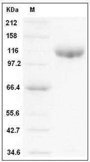 Mouse IL6ST / CD130 Protein (His & Fc Tag) SDS-PAGE