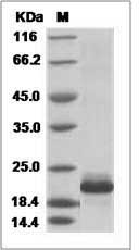 Human IL1F10 / IL-38 Protein (His Tag)