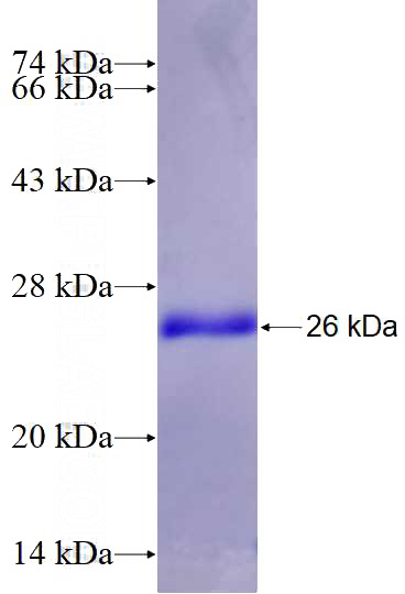 Recombinant Human CREG2 SDS-PAGE