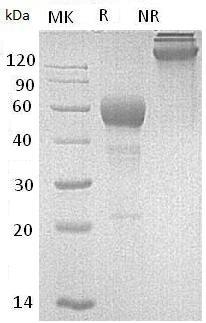 Mouse Fas/Apt1/Tnfrsf6 (Fc tag) recombinant protein