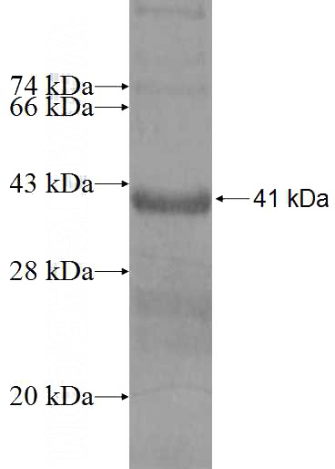 Recombinant Human RPS15A SDS-PAGE
