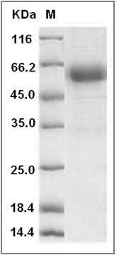 Rat TNFR1 / CD120a / TNFRSF1A Protein (Fc Tag) SDS-PAGE