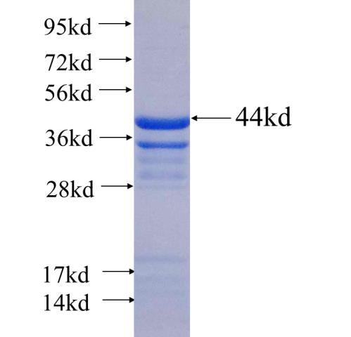 Recombinant human COL6A1 SDS-PAGE