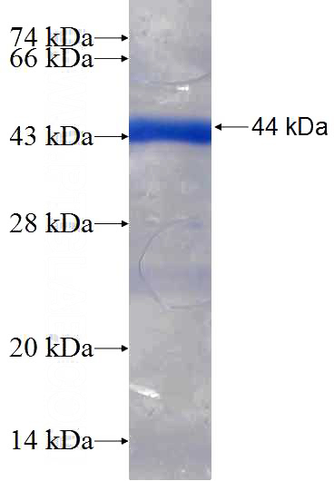Recombinant Human ADAM7 SDS-PAGE