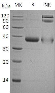Human C1QTNF1/CTRP1/UNQ310/PRO353 (His tag) recombinant protein