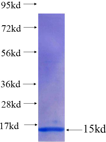 Recombinant Human FIBIN SDS-PAGE