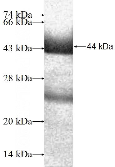 Recombinant Human AGL SDS-PAGE