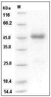 Human CCN3 / NOV Protein (His Tag) SDS-PAGE