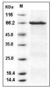 Human CSK / C-Src kinase Protein (GST Tag) SDS-PAGE