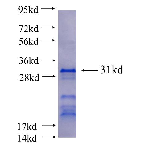 Recombinant human PRPF40A SDS-PAGE