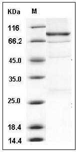 Human IGF2BP2 / IMP2 / p62 Protein (His & GST Tag) SDS-PAGE