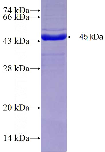Recombinant Human RPL17 SDS-PAGE