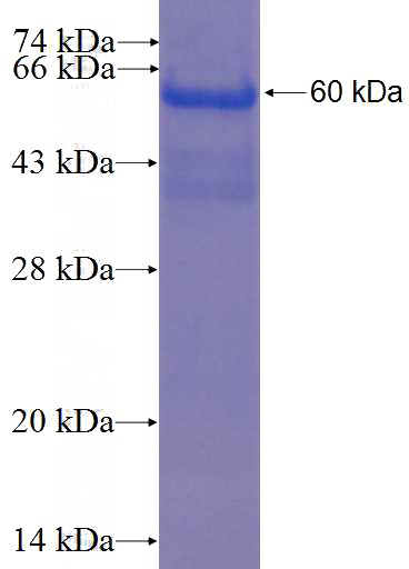 Recombinant Human LRP2BP SDS-PAGE