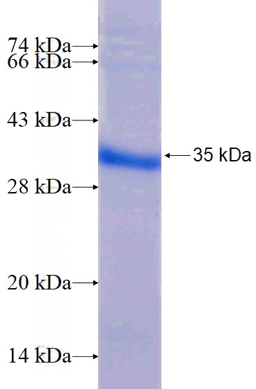 Recombinant Human UBE3A SDS-PAGE
