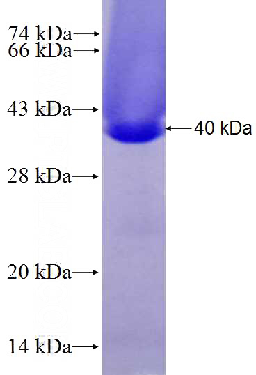 Recombinant Human CRYM SDS-PAGE