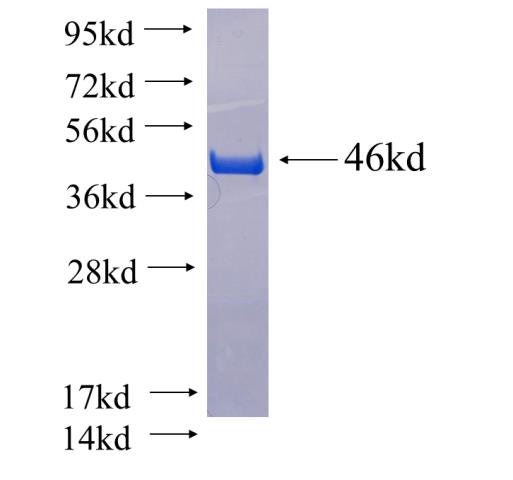 Recombinant human CDKAL1 SDS-PAGE